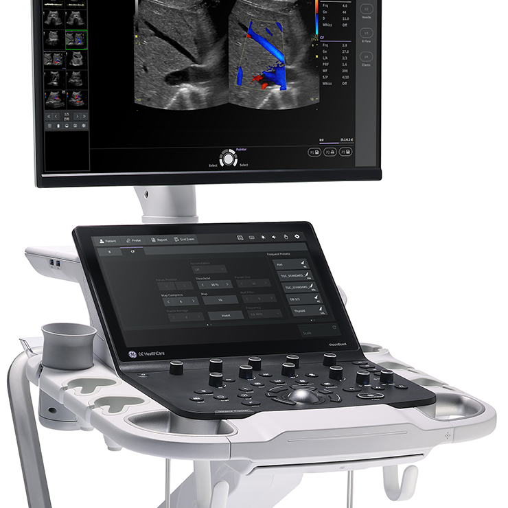 Versana-Premier-R3-4PP_NoProbe_Right-(1) Versana-Premier-R3-4PP_NoProbe_Right-(1)